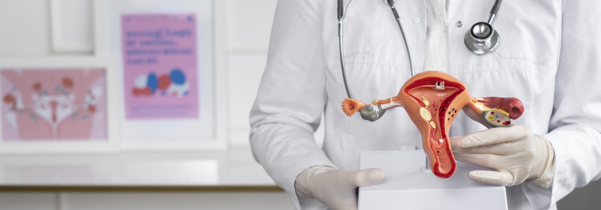 Front view doctor holding anatomic model showing how uterine fibroid embolisation works