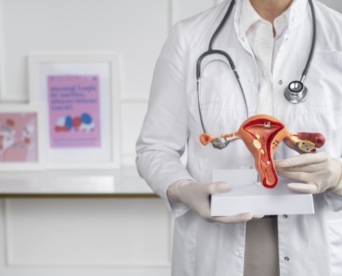 Front view doctor holding anatomic model showing how uterine fibroid embolisation works