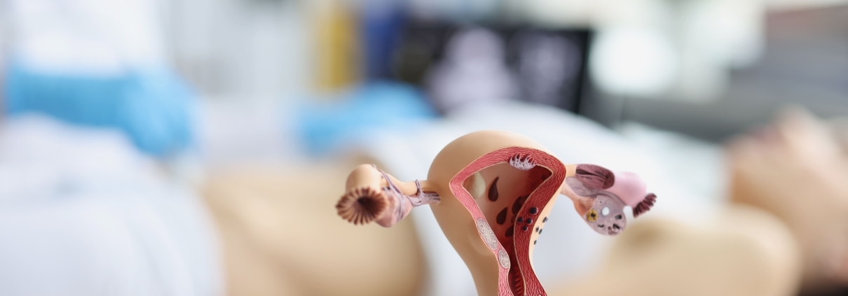Anatomical model of a uterus and ovaries in front of a female patient being examined, showing the long-term success of uterine fibroid embolisation