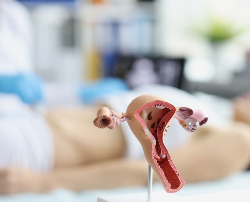Anatomical model of a uterus and ovaries in front of a female patient being examined, showing the long-term success of uterine fibroid embolisation