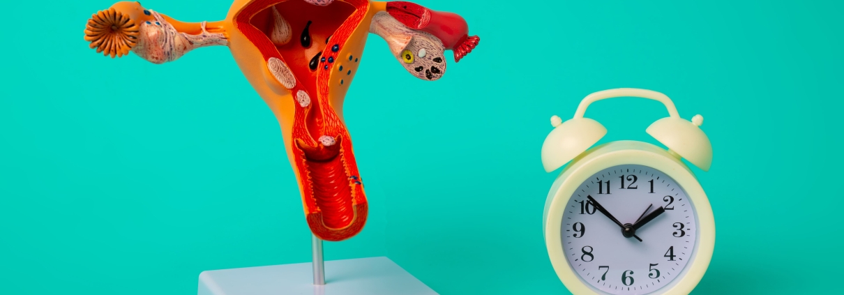 An anatomical model of a woman’s womb with a clock and medication comparing uterine fibroid embolisation vs. medication